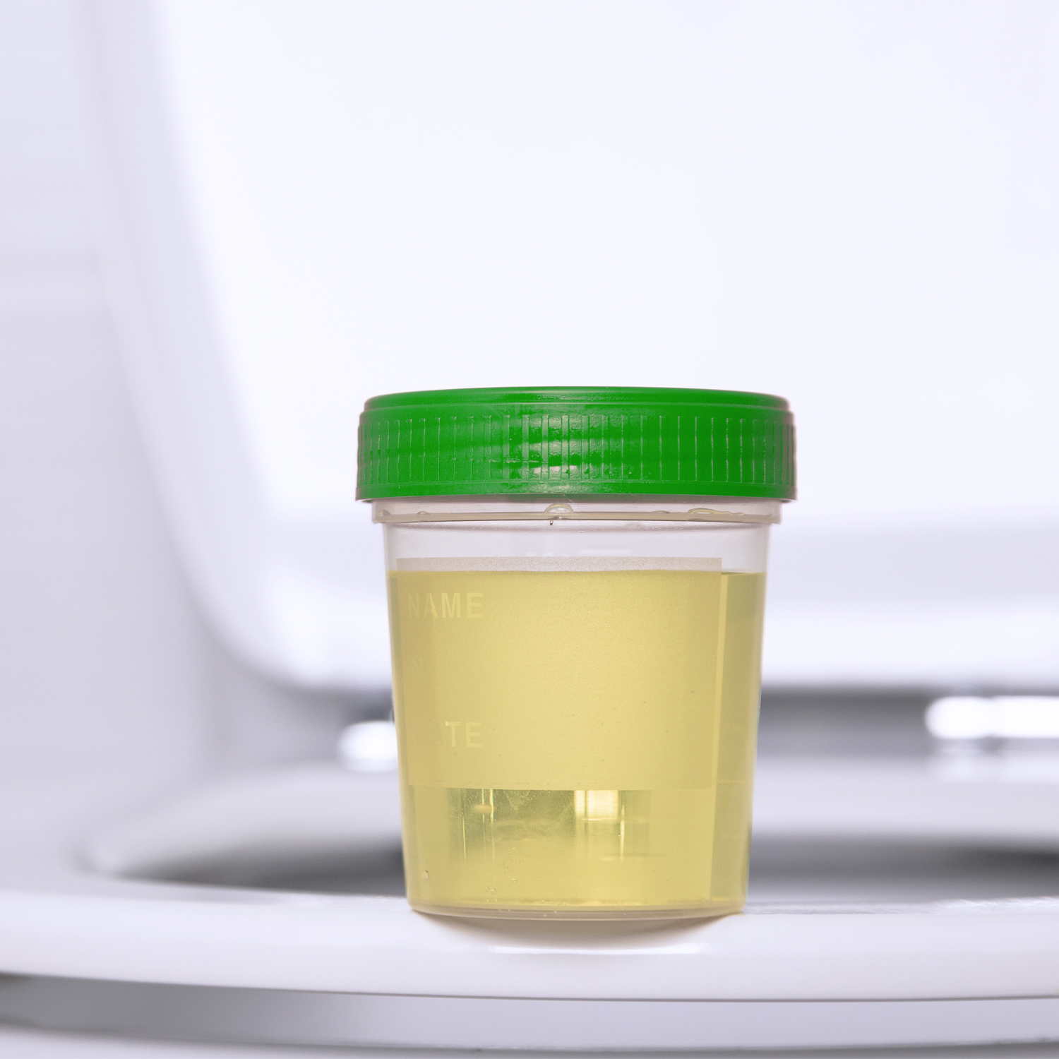 Urinbecher mit Schraubdeckel 125 ml – Bild 2